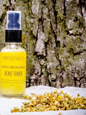 Calendula and Chamomile Acne Toner - TOP SELLER